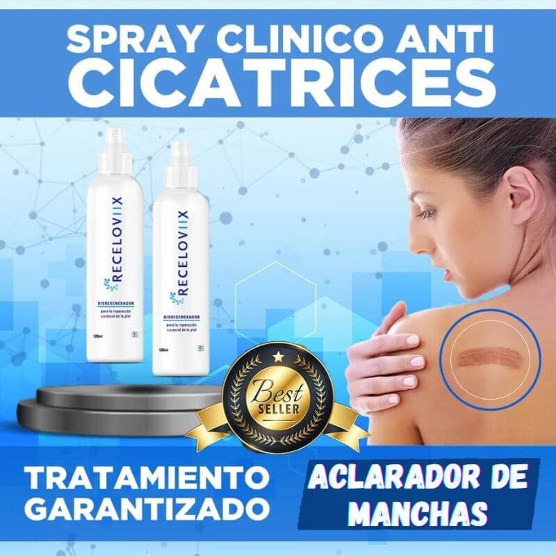 Miniatura 2 de RECELOVIIX